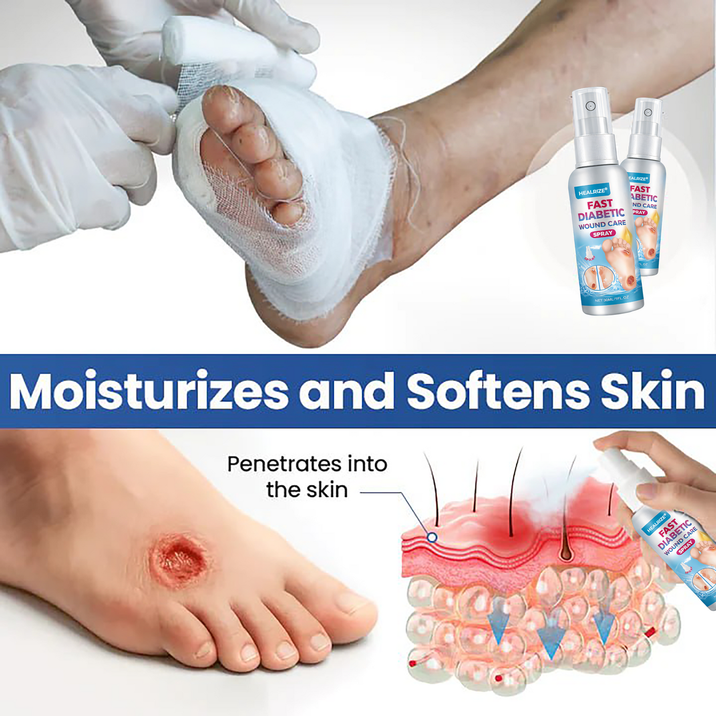 Healrize® Fast Diabetic Wound Care Spray 🎇 New-Year Sale: 60% OFF 🔥