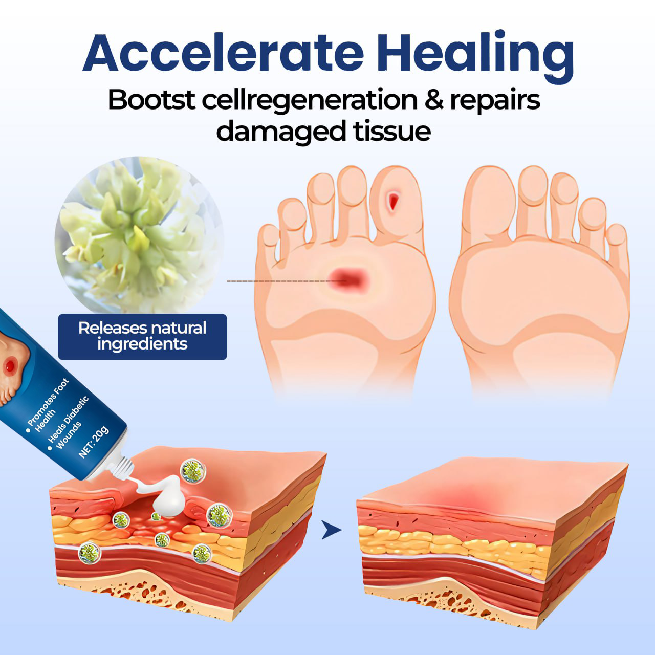 CVREOZ® UltraHeal Diabetic's Foot Cream