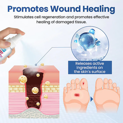 Healrize® Fast Diabetic Wound Care Spray 🎇 New-Year Sale: 60% OFF 🔥