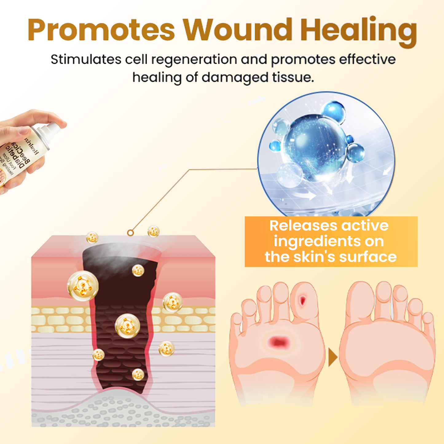 ⏰Last Day Promotion: 60% OFF🔥Healrize® DiaCure Bee Venom & Centella Diabetic Foot Ulcer Spray