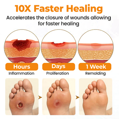 ⏰Last Day Promotion: 60% OFF🔥Healrize® DiaCure Bee Venom & Centella Diabetic Foot Ulcer Spray