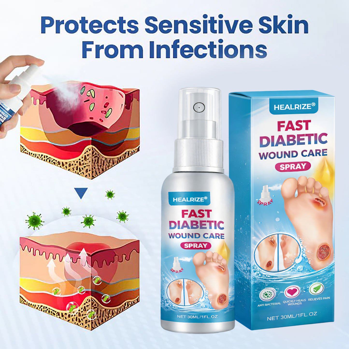 Healrize® Fast Diabetic Wound Care Spray 🎇 New-Year Sale: 60% OFF 🔥