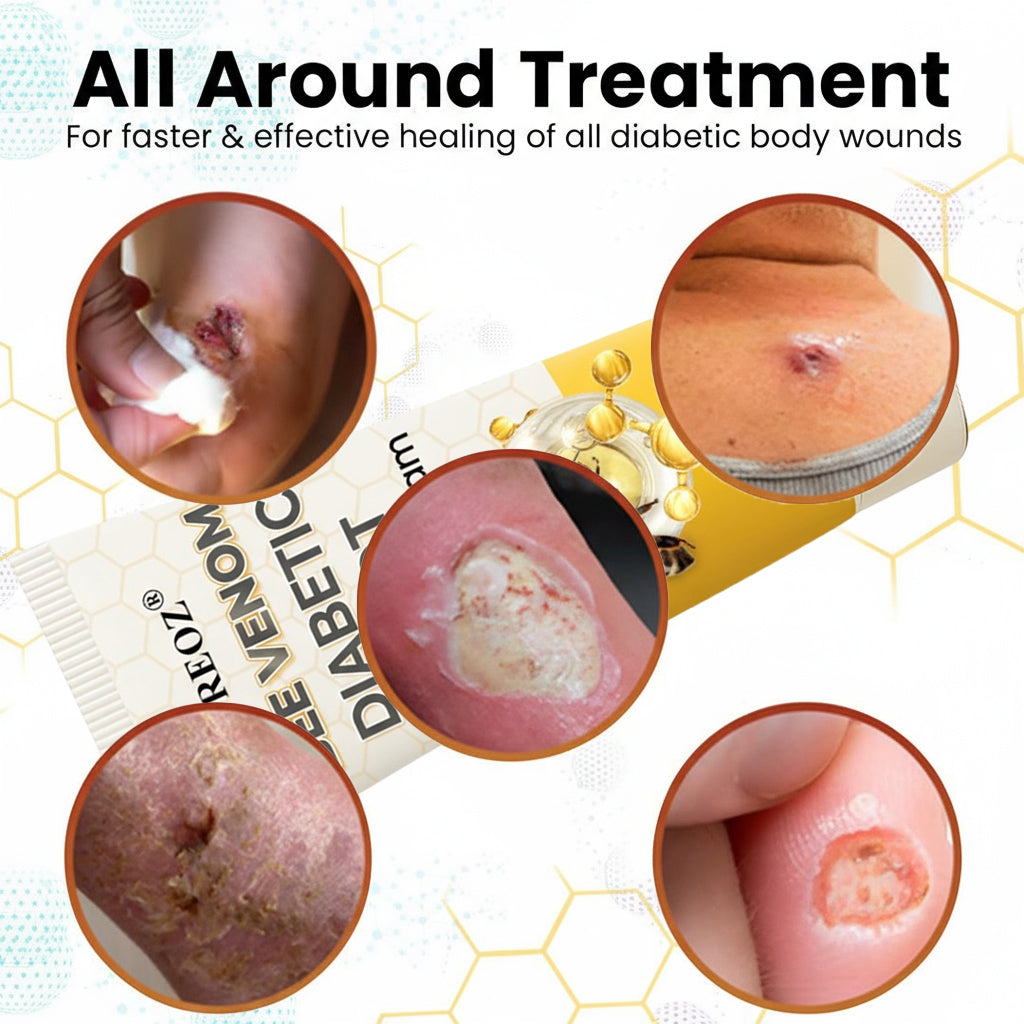 🎉SPECIAL OFFER: 60% OFF🔥 8M+ SOLD️🏆 CVREOZ® Bee Venom Diabetic Foot Healing Cream