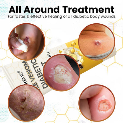 🎉SPECIAL OFFER: 60% OFF🔥 8M+ SOLD️🏆 CVREOZ® Bee Venom Diabetic Foot Healing Cream