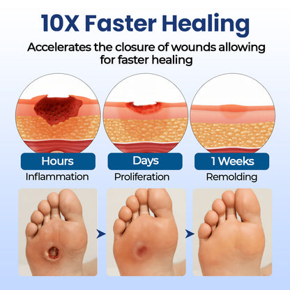 CVREOZ® UltraHeal Diabetic's Foot Cream