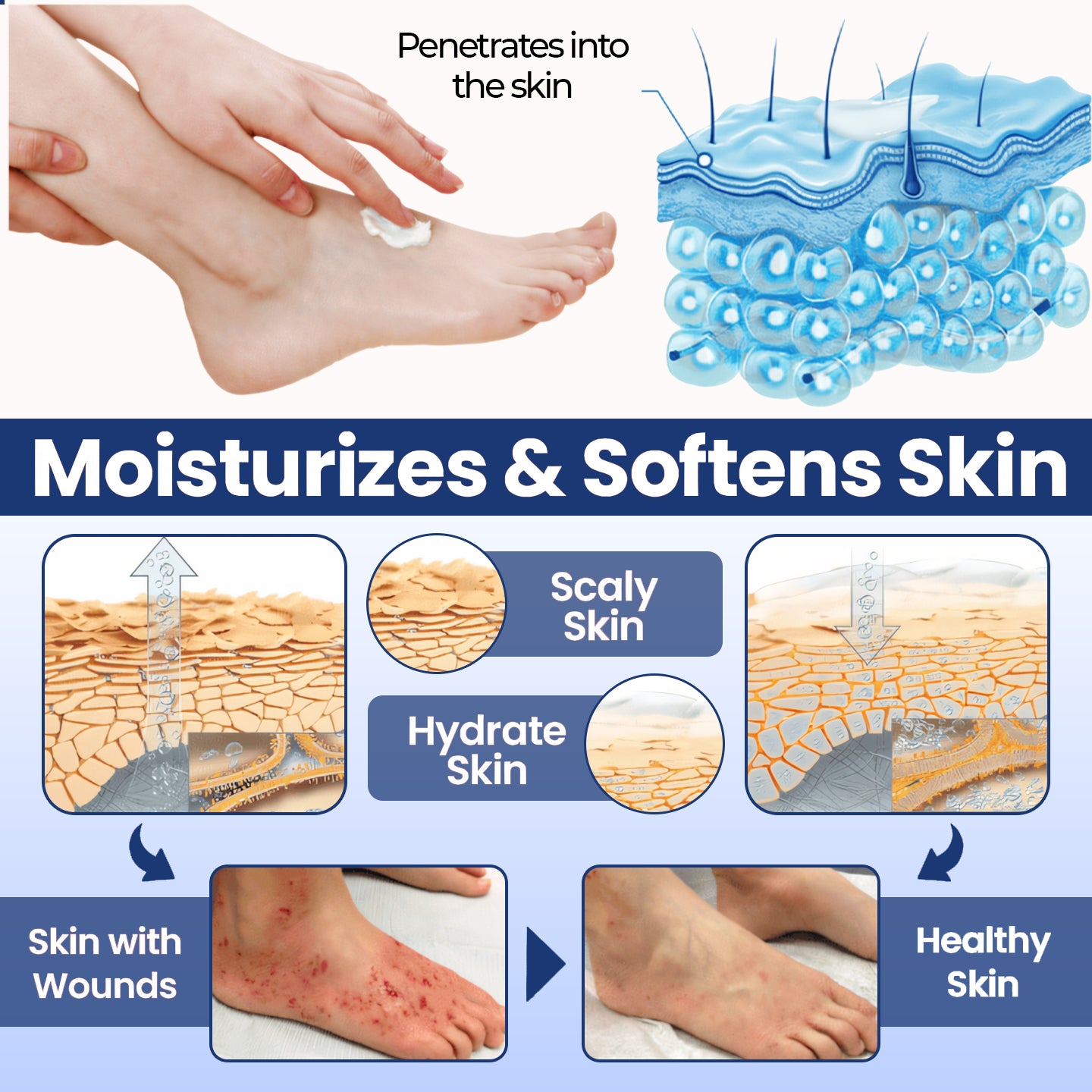 CVREOZ® UltraHeal Diabetic's Foot Cream