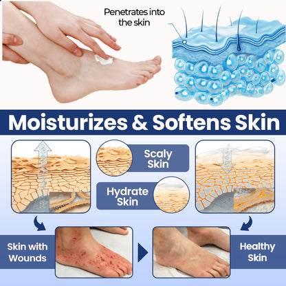 CVREOZ® UltraHeal Diabetic's Foot Cream