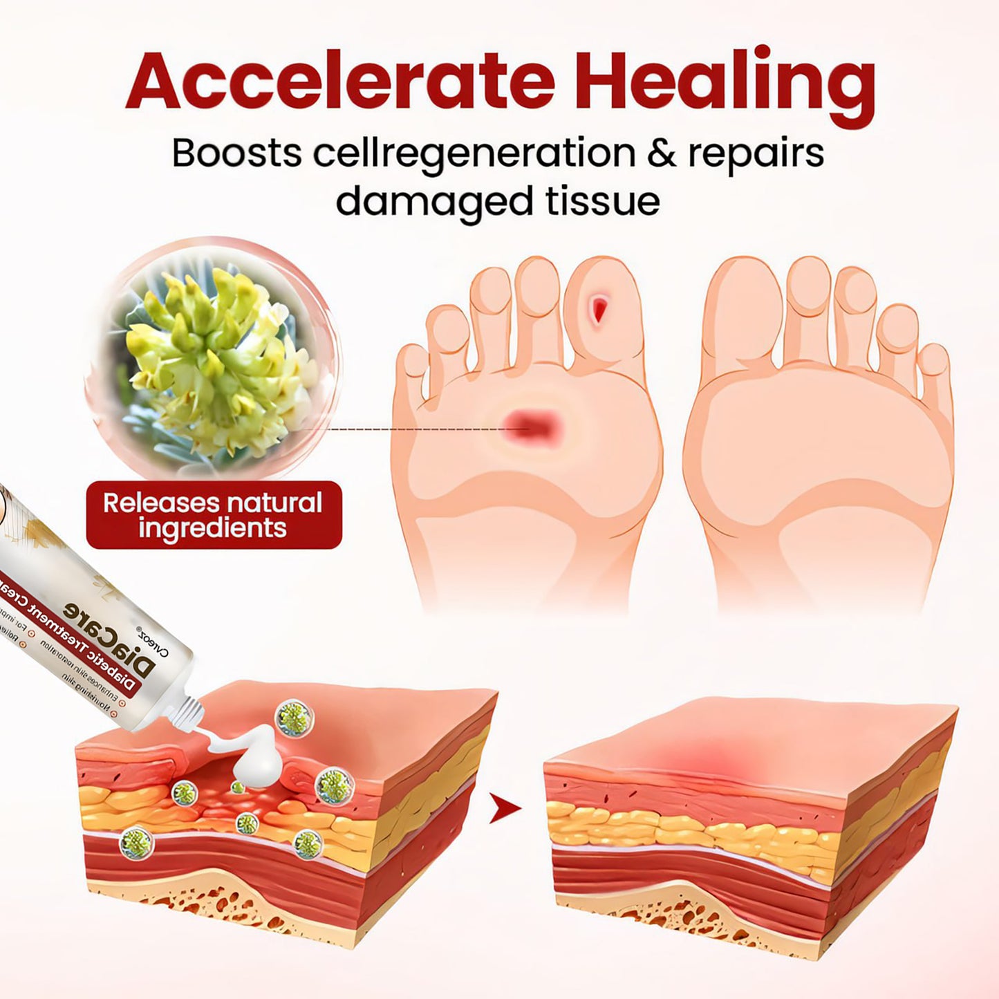 CVREOZ® DiaCare Diabetic Treatment Cream