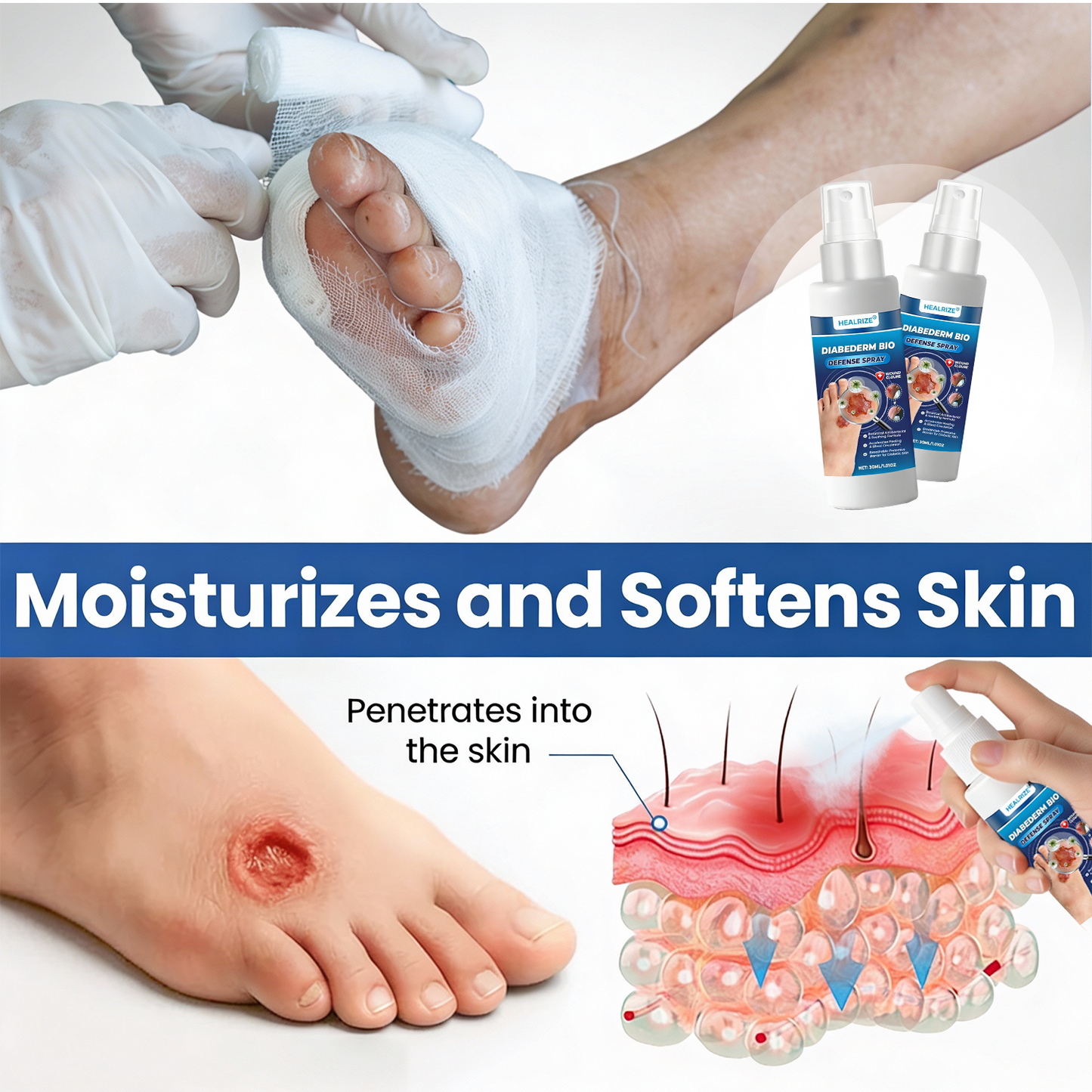 HEALRIZE® DIABEDERM BIO-DEFENSE SPRAY (upsale Carol)