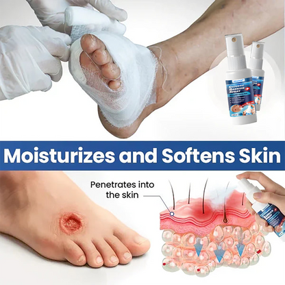 ⏰Last Day Promotion: 60% OFF🔥 Healrize® Glucose Barrier Spray