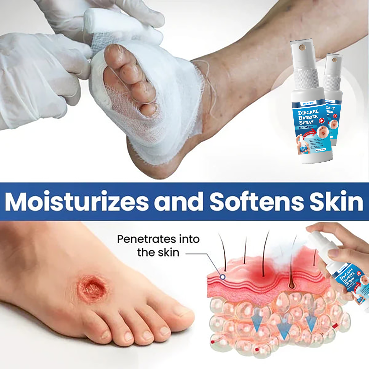 Healrize® DiaCare Barrier Spray