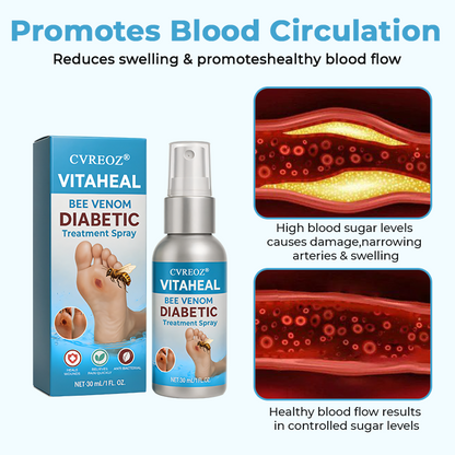 🎉SPECIAL OFFER: 60% Today Only!🔥CVREOZ® VitaHeal Bee Venom Diabetic Treatment Spray