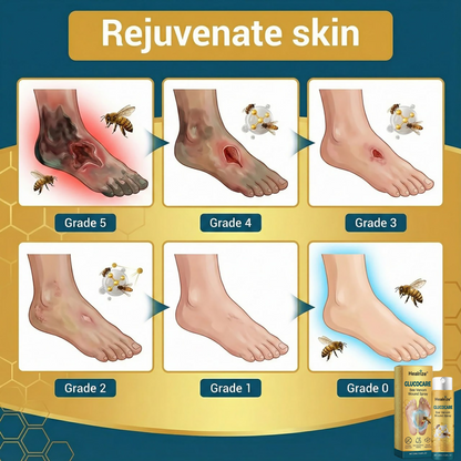 🔥EXCLUSIVE DEAL 60% OFF 🐝 Healrize® GlucoCare Bee Venom Diabetic Wound Spray 💛
