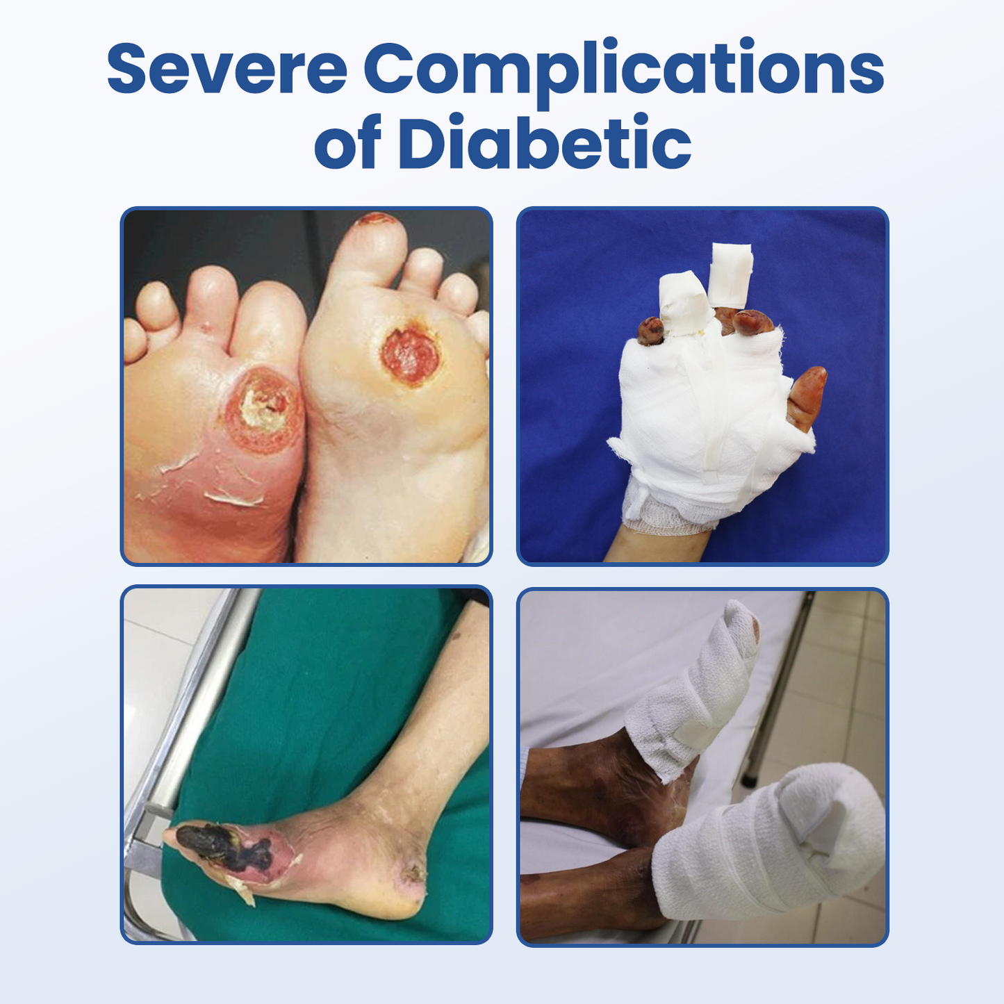 HEALRIZE® DIABEDERM BIO-DEFENSE SPRAY (upsale Carol)