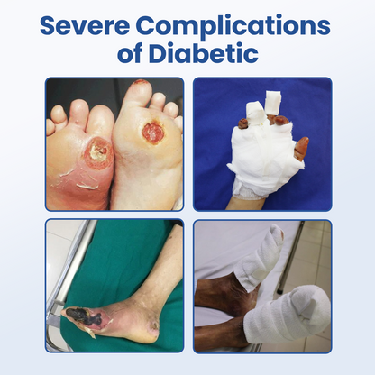 HEALRIZE® DIABEDERM BIO-DEFENSE SPRAY (upsale Carol)