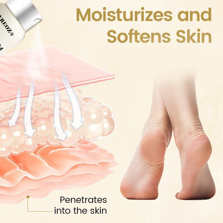 🔥HOT SALE 60% OFF✨ CVREOZ® Bee Venom Diabetic Foot Healing Spray
