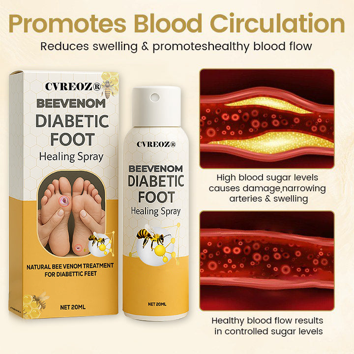🔥HOT SALE 60% OFF✨ CVREOZ® Bee Venom Diabetic Foot Healing Spray