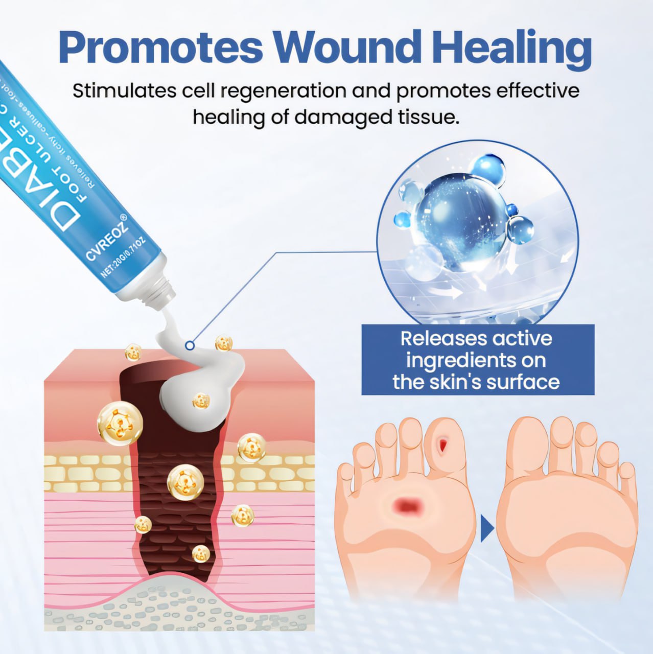 ⏰Last Day Promotion: 60% OFF🔥Crveoz® VenHeal Diabetic Wound Cream.