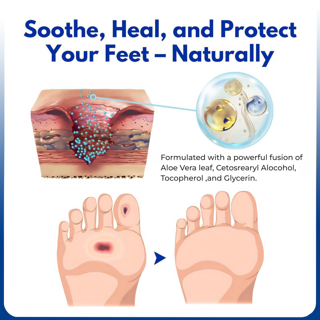 ⏰Last Day Promotion: 60% OFF🔥Crveoz® VenHeal Diabetic Wound Cream.