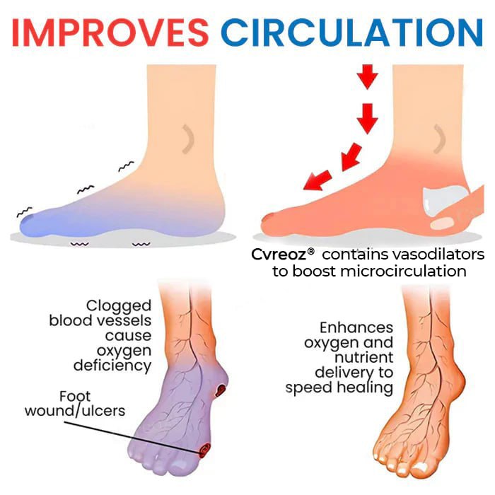 CVREOZ® Diabetic's Foot Cream