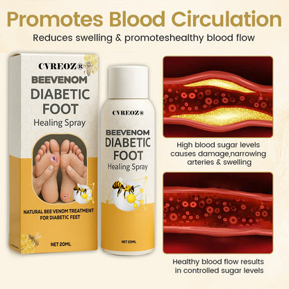 🎉SPECIAL OFFER: 60% OFF This Today Only!🔥 CVREOZ® Bee Venom Diabetic Foot Healing Spray