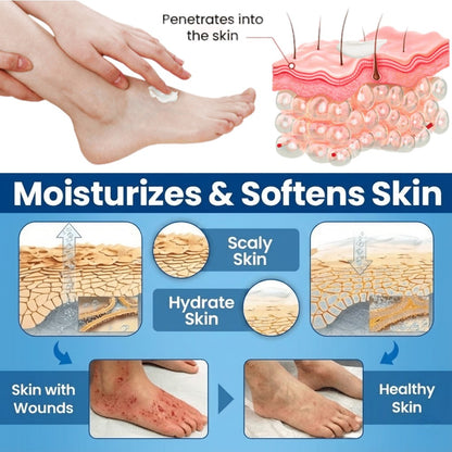 🔥Flash Sale: 60% OFF Today ONLY! Healrize® GlucoHeal Diabetic Foot Healing Cream